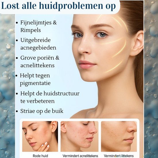 Dermapen - Microneedling Pen 3 in 1 met Serum Infusie en EMS – Professionele Huidverbetering